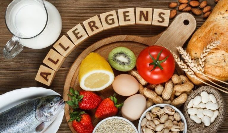 Causes, Diagnosis, and Treatment of Allergies
